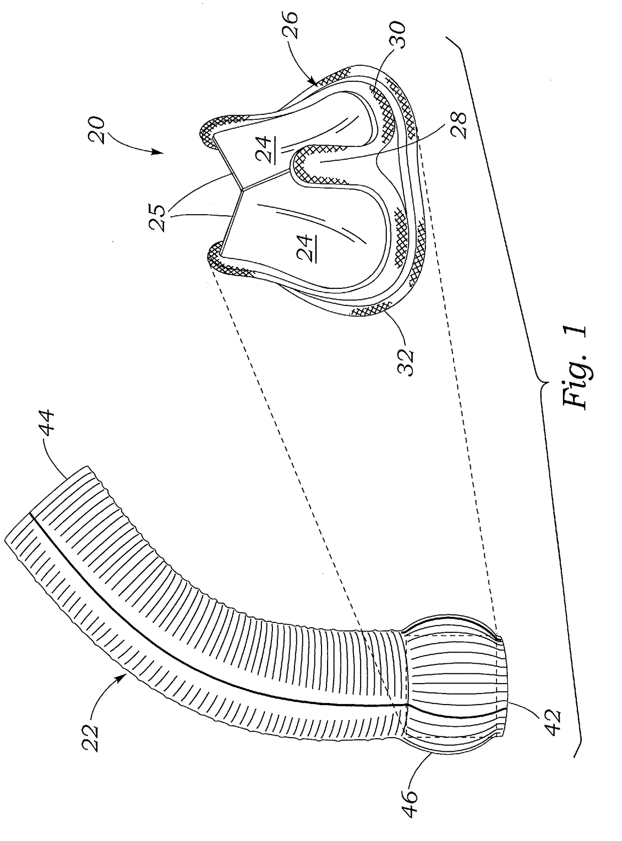 Valved aortic conduits