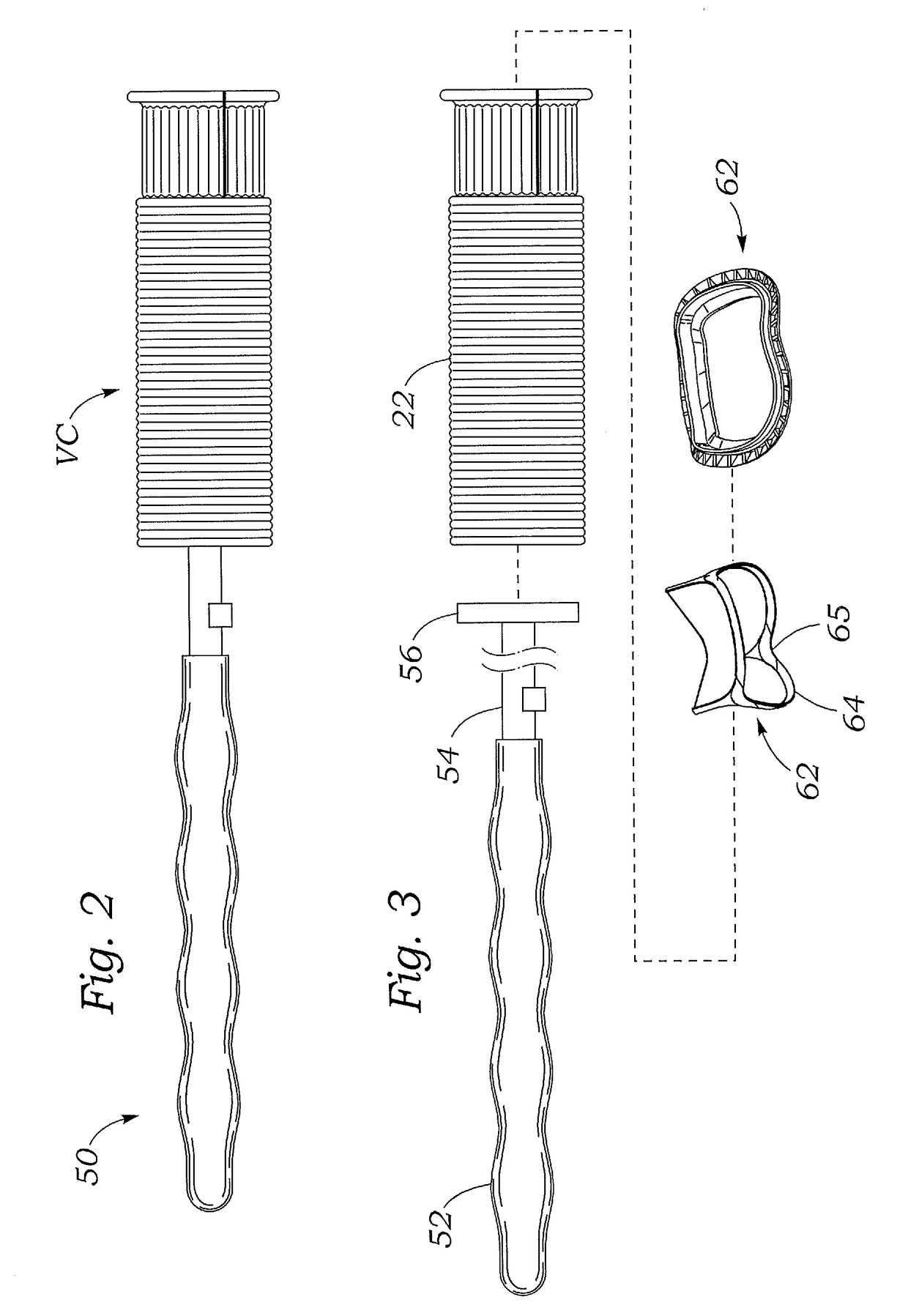 Valved aortic conduits