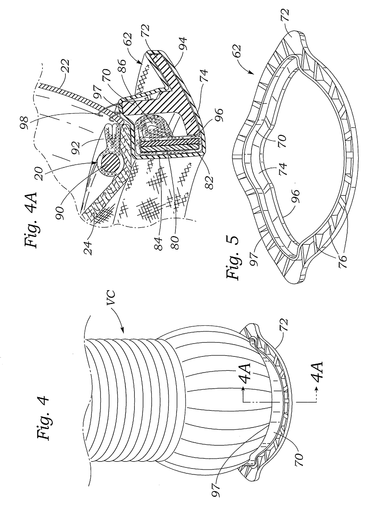 Valved aortic conduits