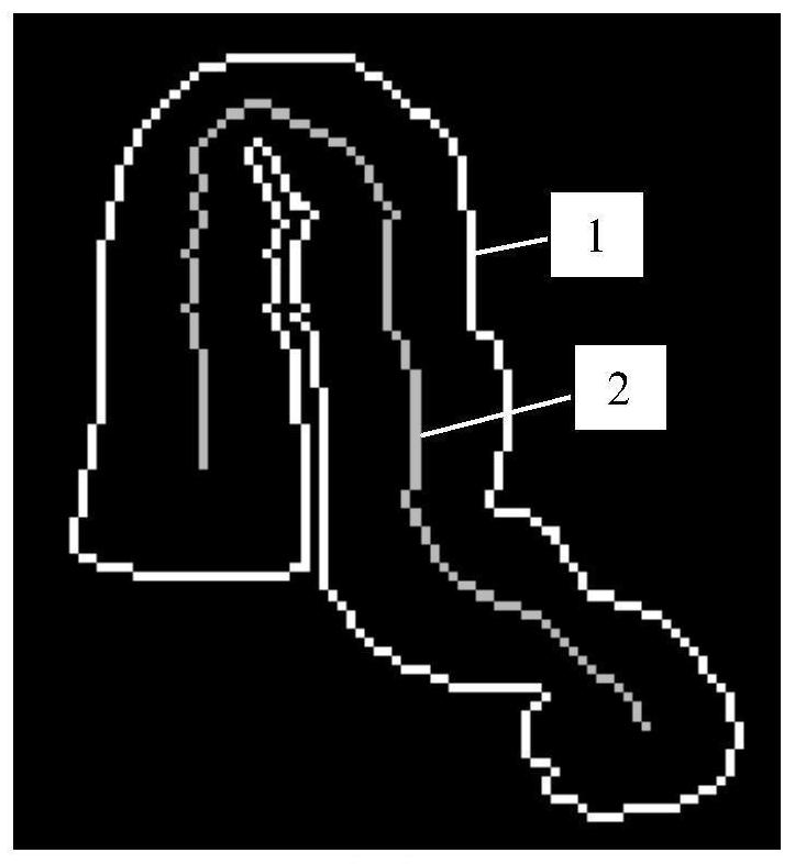 Abdomen DR image processing method and system