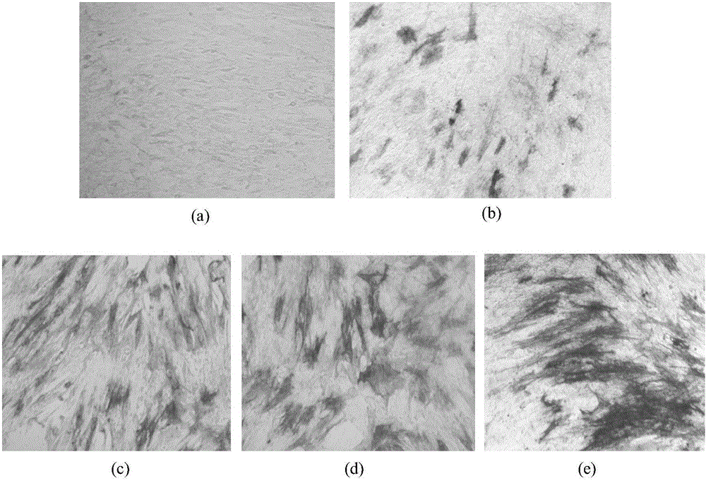 Application of oncostatin M in preparation of products for promoting mesenchymal stem cells to be in vitro directionally differentiated into bone cells