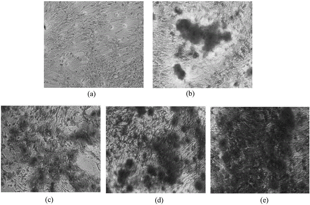 Application of oncostatin M in preparation of products for promoting mesenchymal stem cells to be in vitro directionally differentiated into bone cells