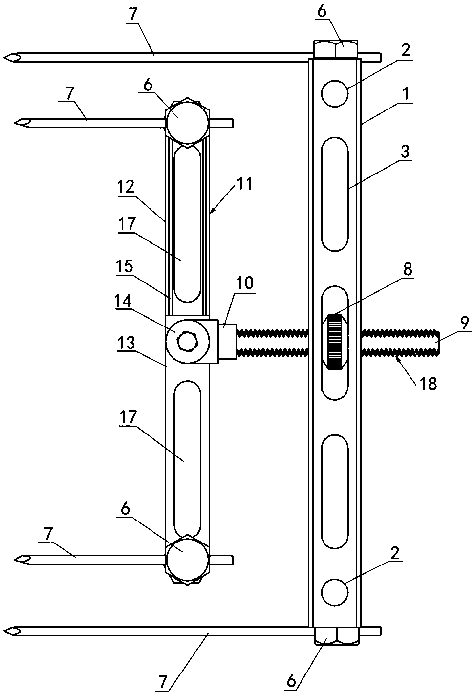 Bone Retractor