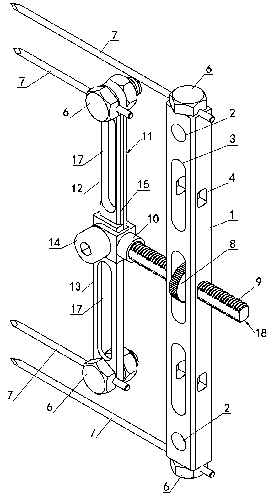 Bone Retractor