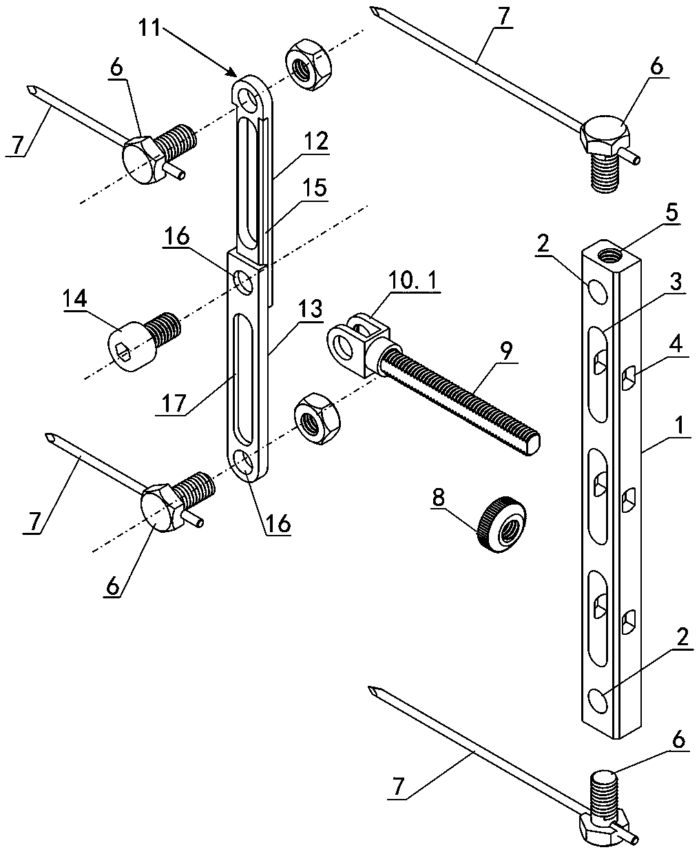 Bone Retractor