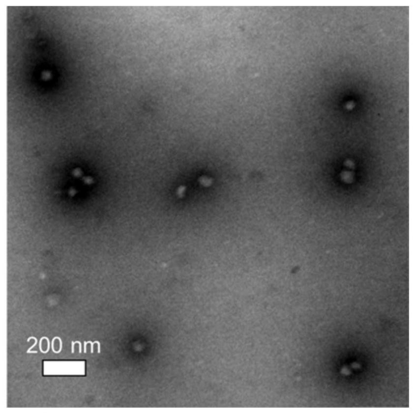 A Sorafenib-gene co-loaded nano-medicine for cancer treatment and its preparation method and application