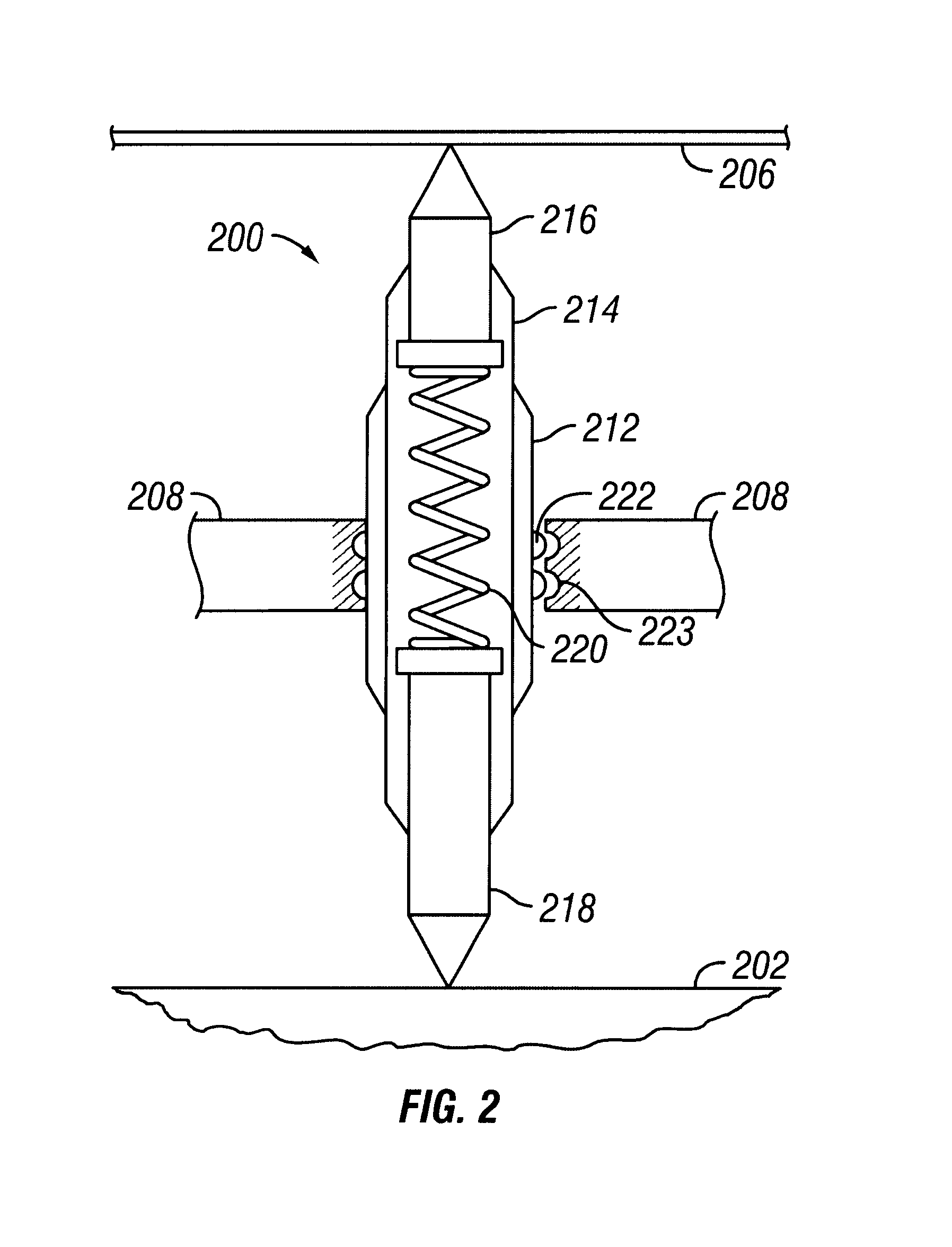 Method and apparatus for the management of forces in a wireless fixture