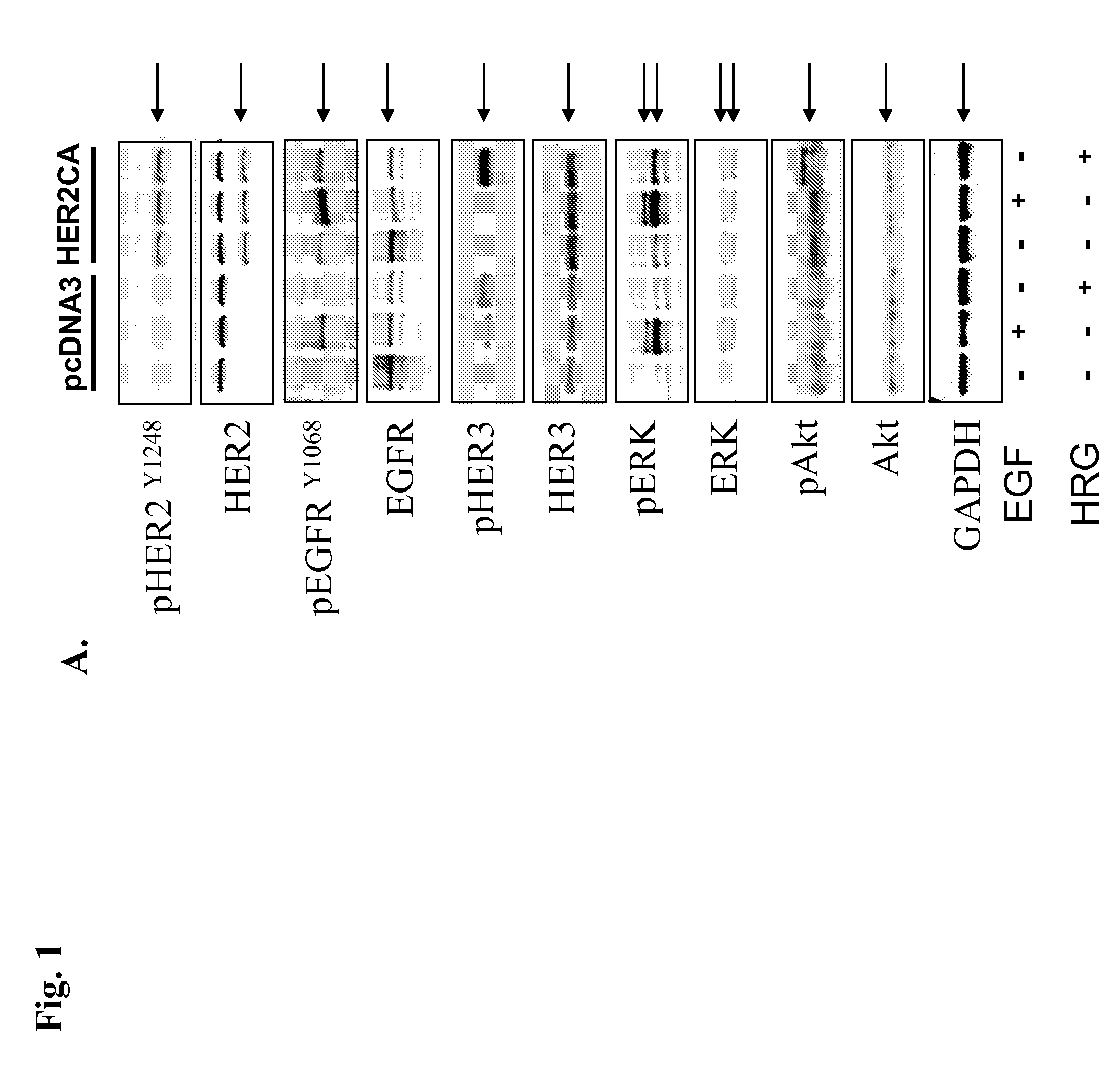 Use of tyrosine kinase inhibitors for treatment of prolactinoma