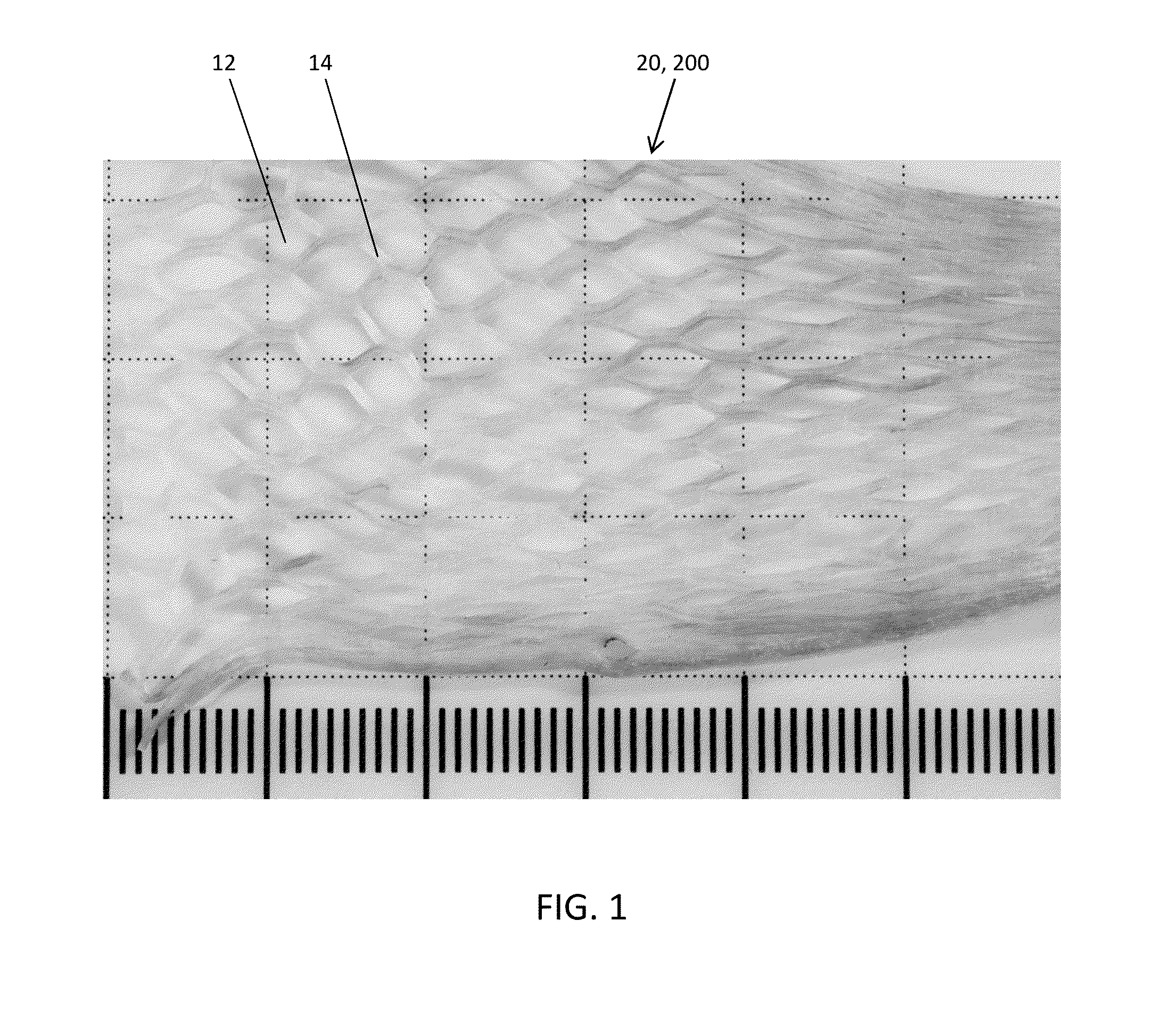 Fenestrated bone wrap graft