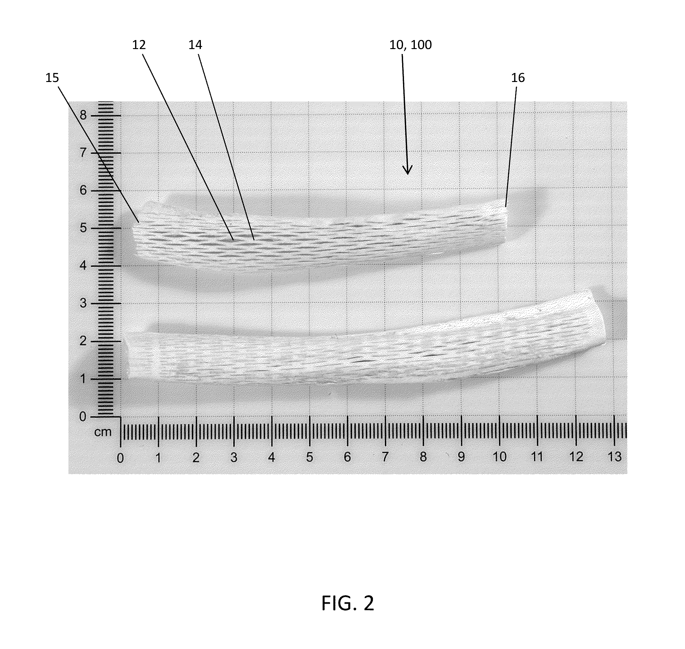 Fenestrated bone wrap graft