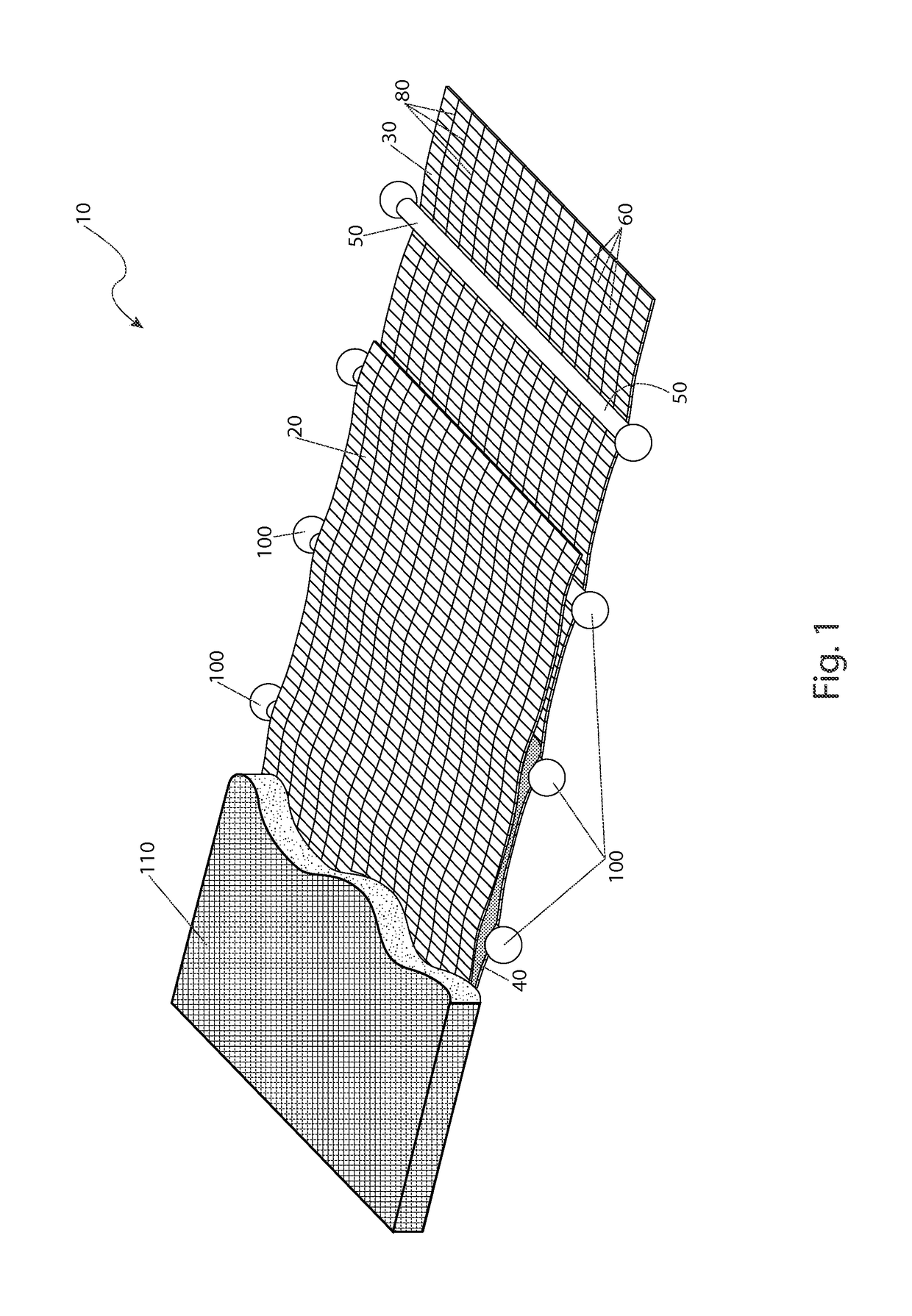 Splinted compression bandage