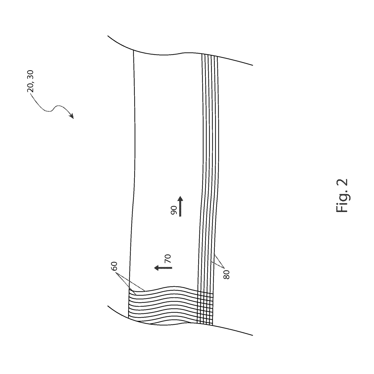 Splinted compression bandage