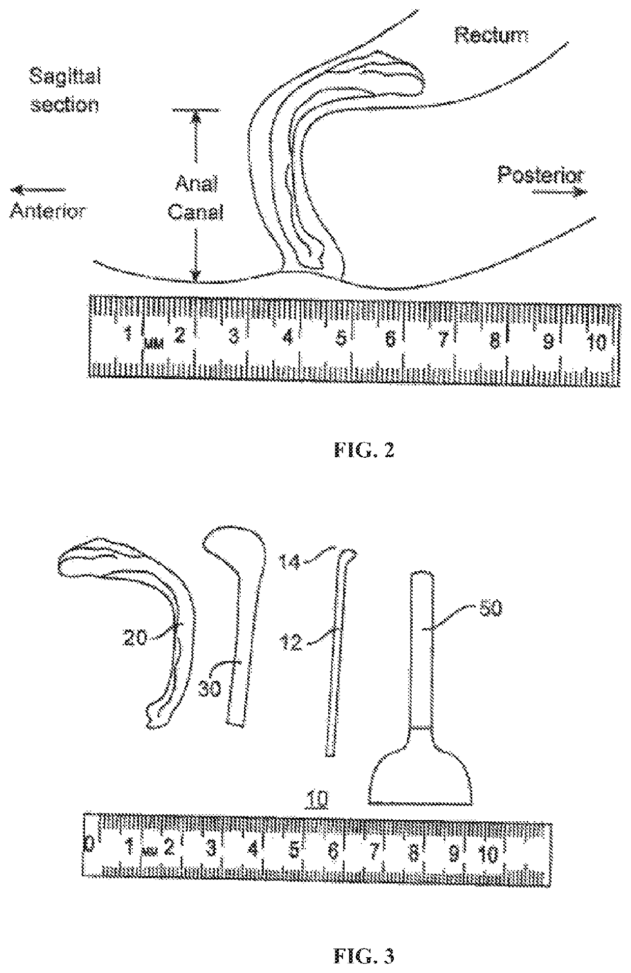 Fecal incontinence device for positioning in the lower rectum