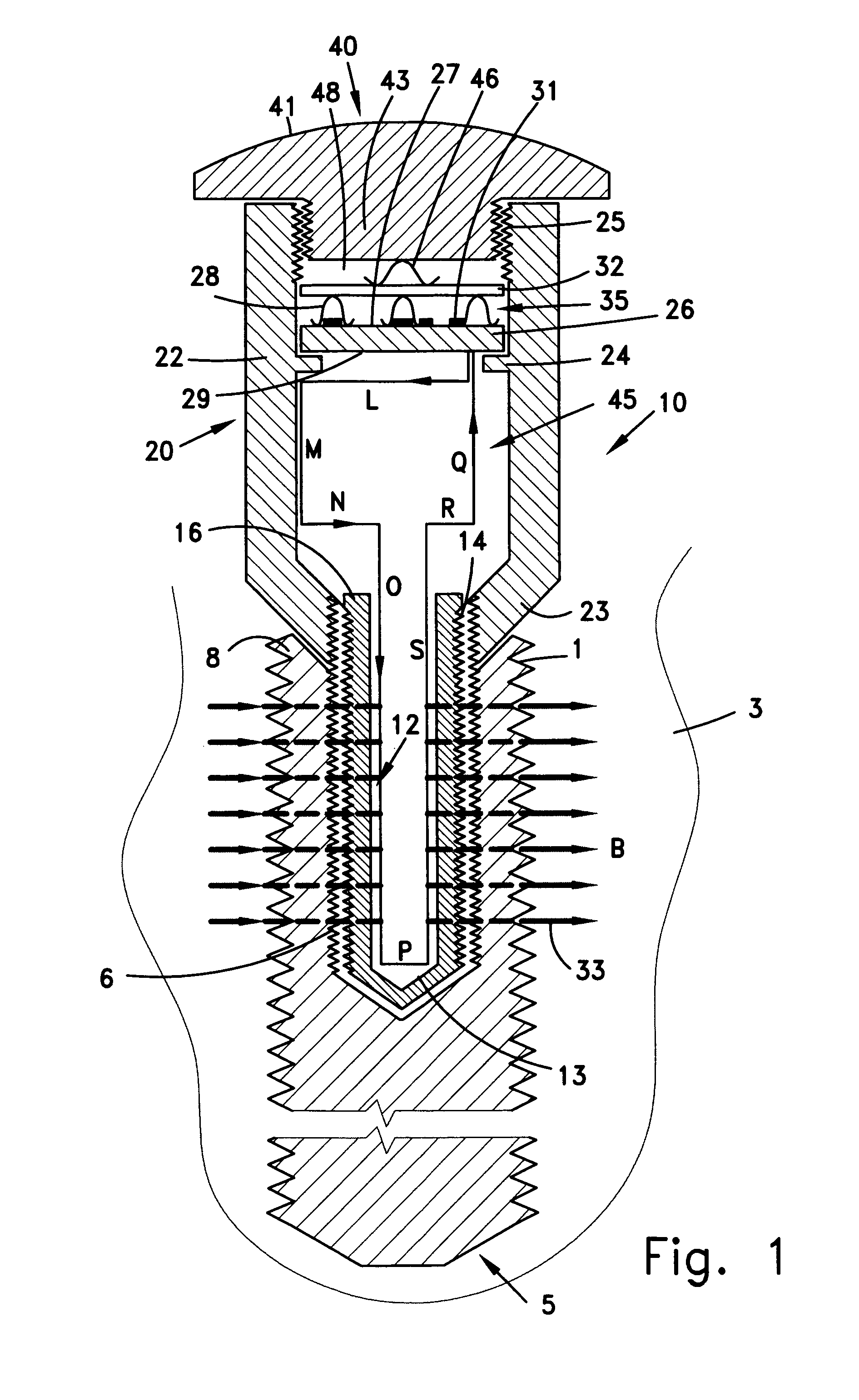 Implant device for stimulating osteogenesis and osseointegration