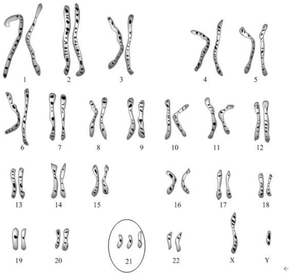 Kit for 21-trisomy risk detection