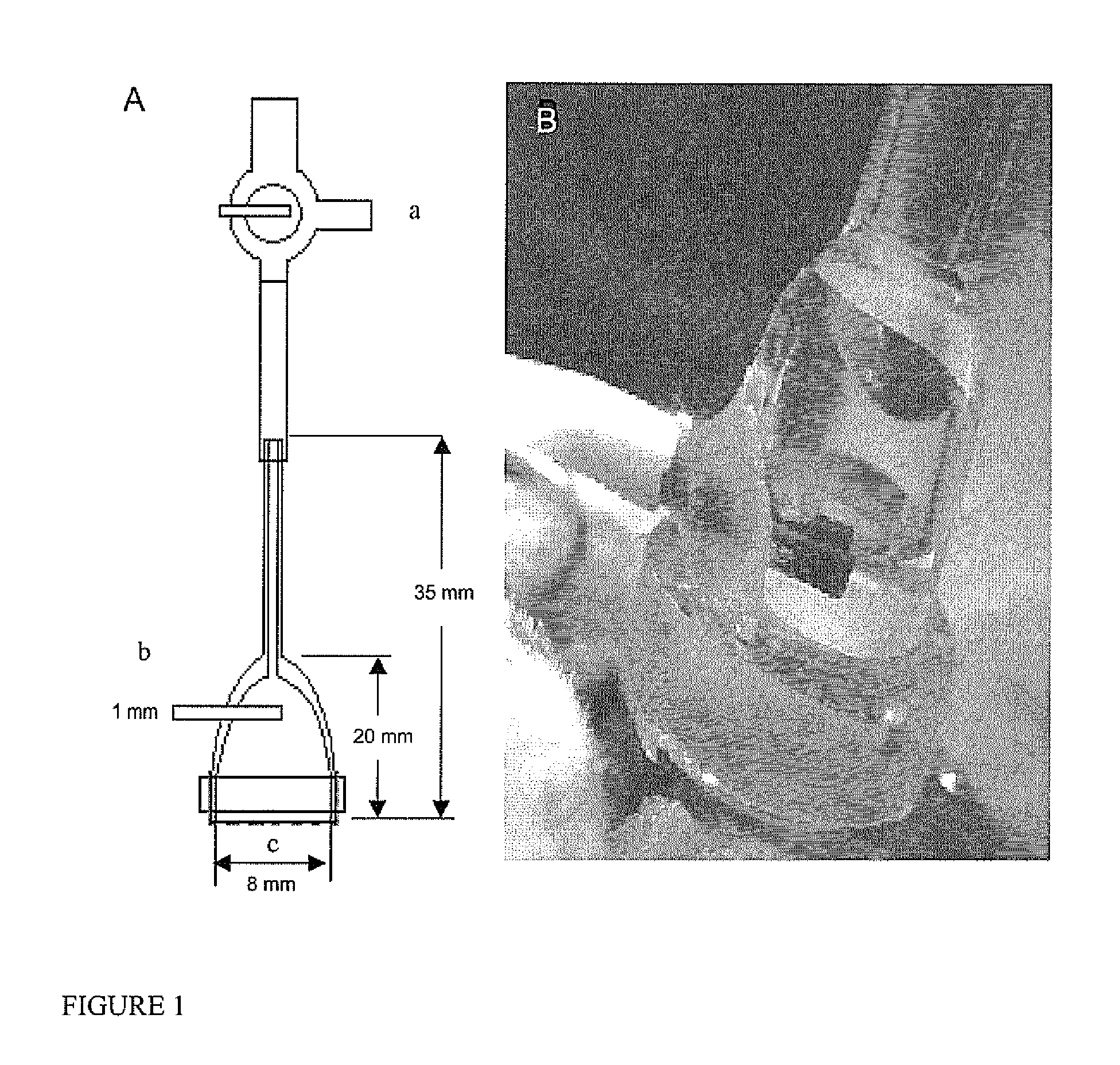 Device to reduce brain edema by surface dialysis and cooling