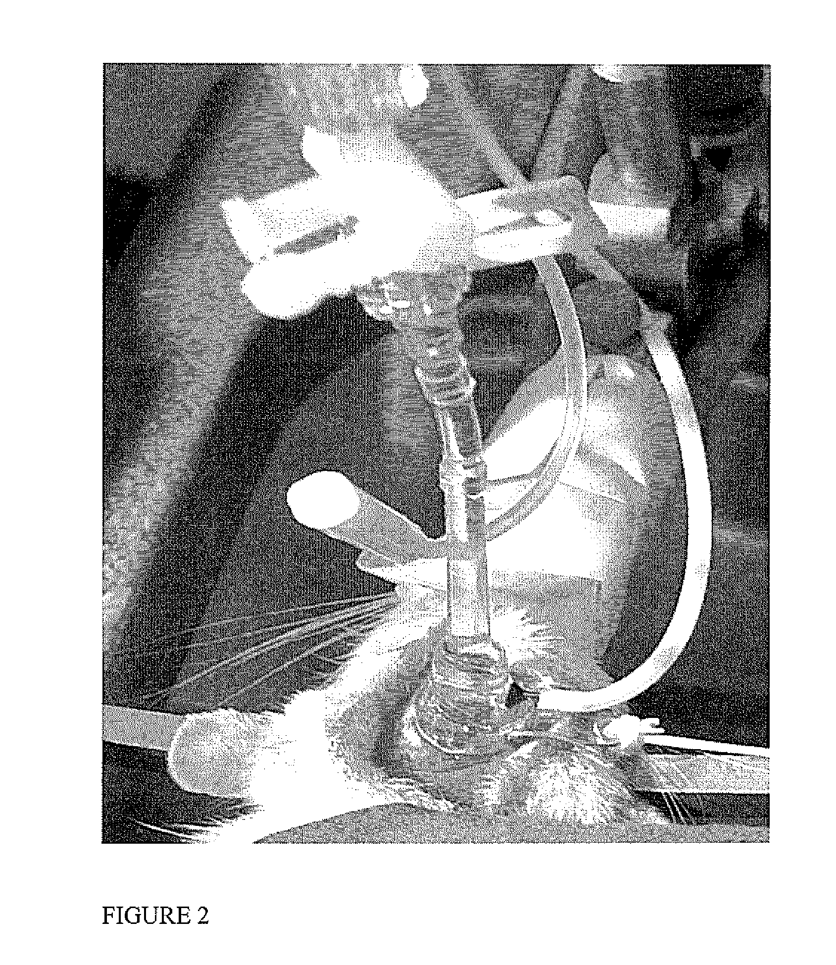 Device to reduce brain edema by surface dialysis and cooling