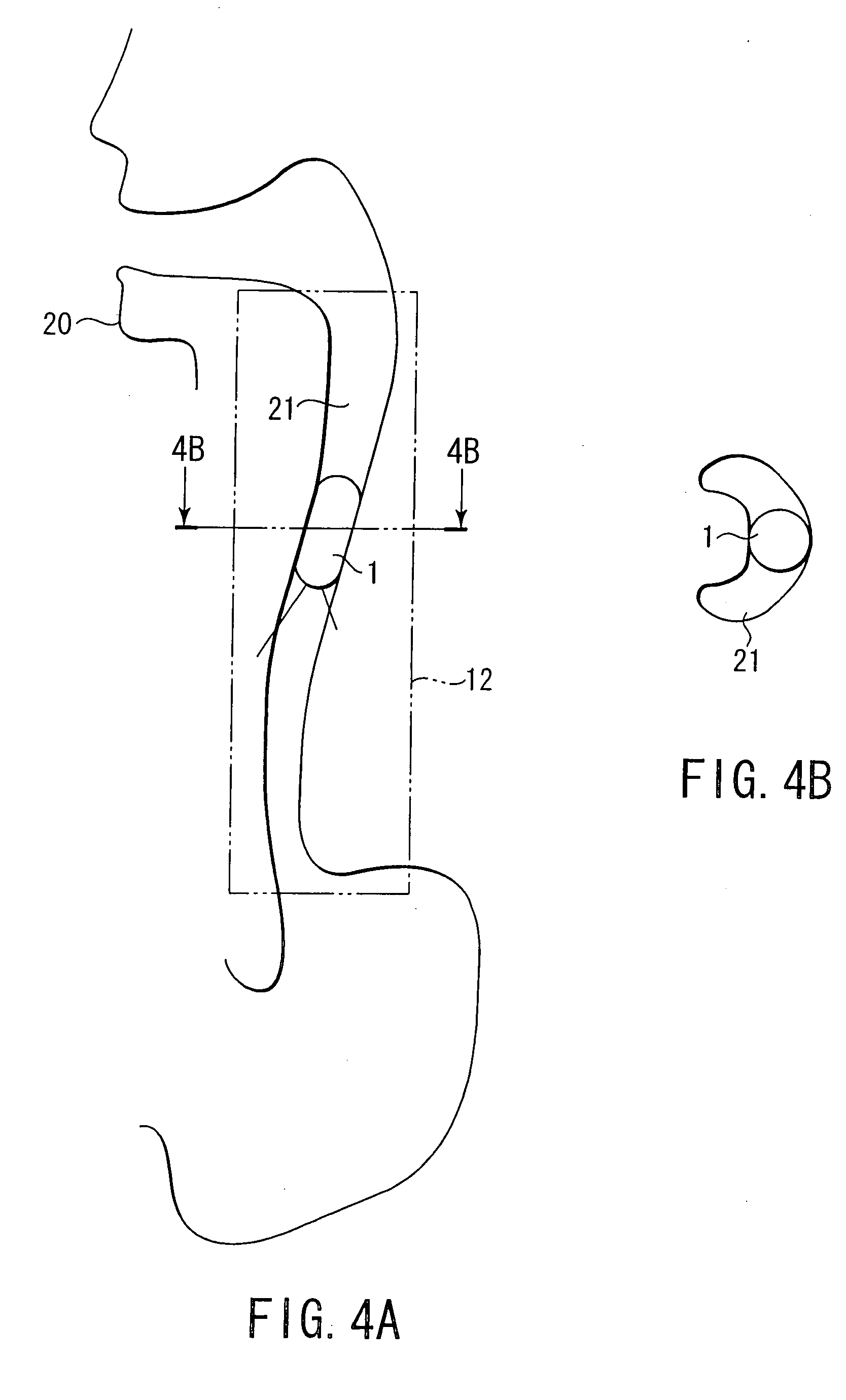 Capsule type endoscope