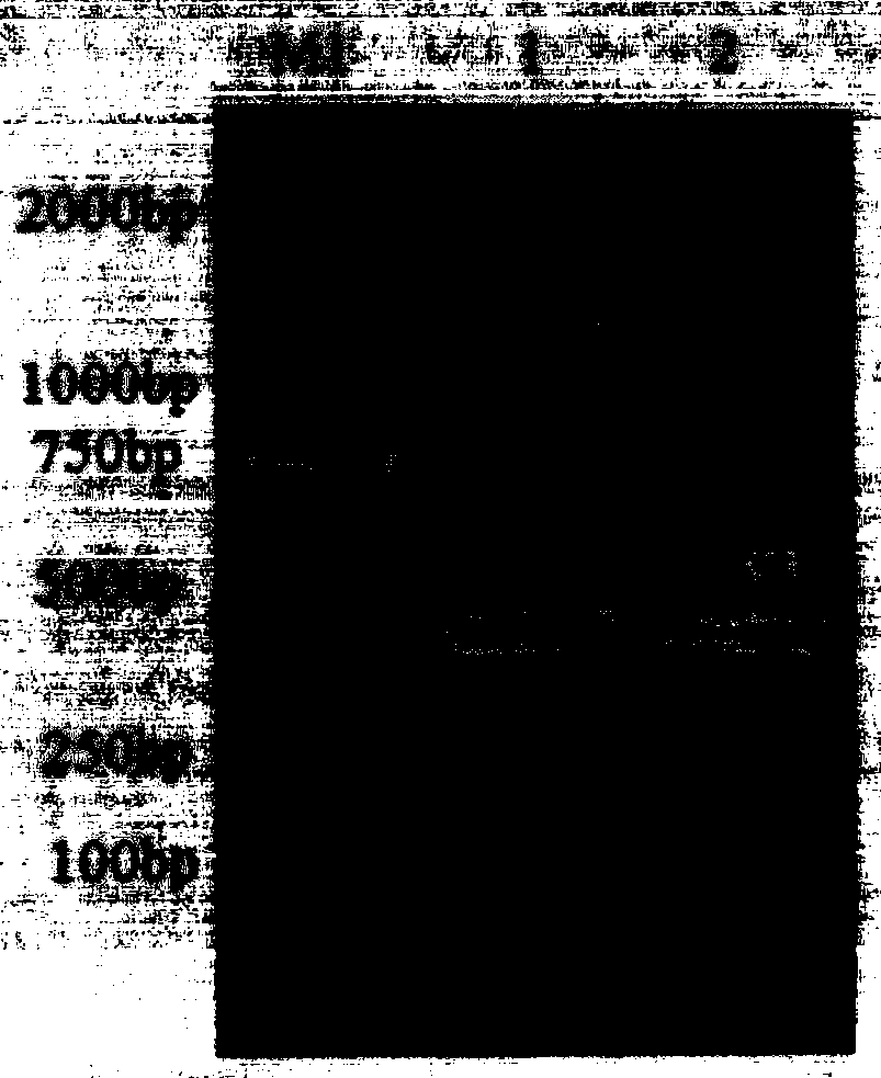 Anti-influenza A virus and novel universal epitope vaccine and preparing method thereof