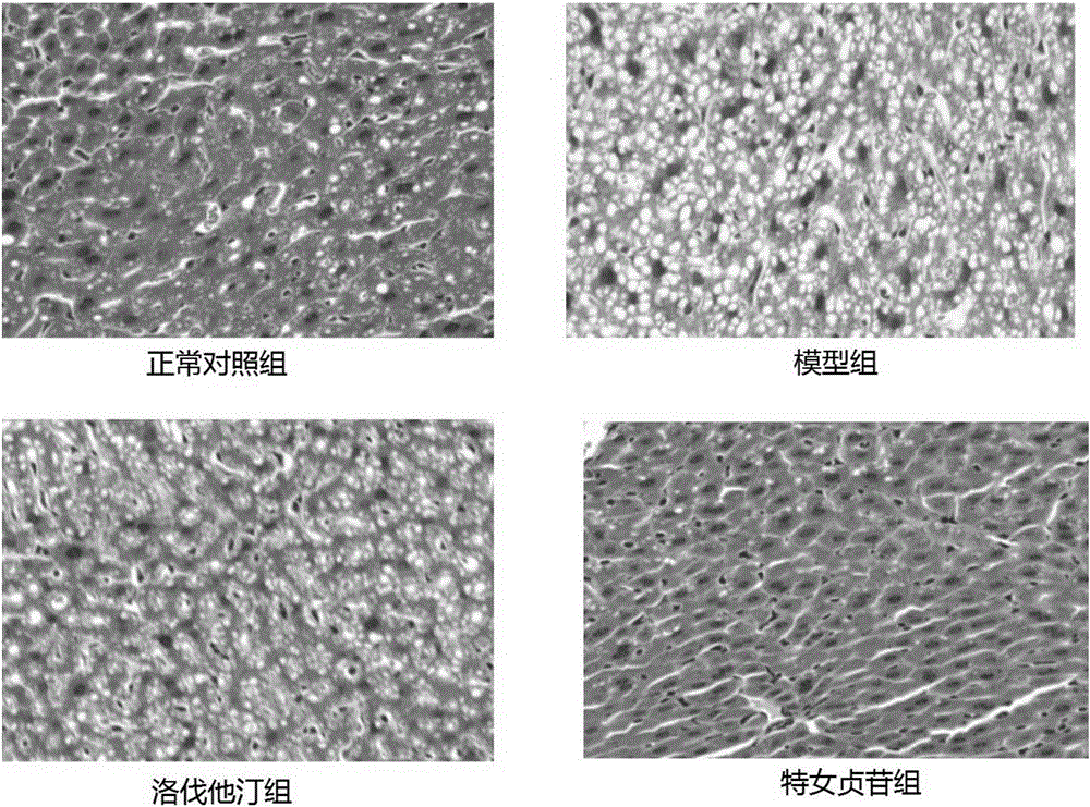 Application of specnuezhenide, composition and medicinal preparation thereof in lipid reduction