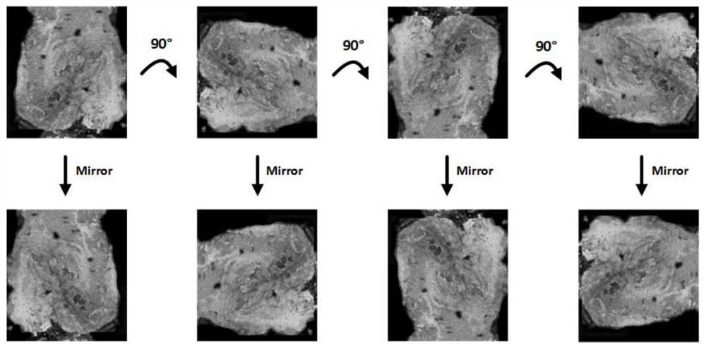 A deep learning-based three-dimensional ultrasound abdominal wall hernia patch detection method and system