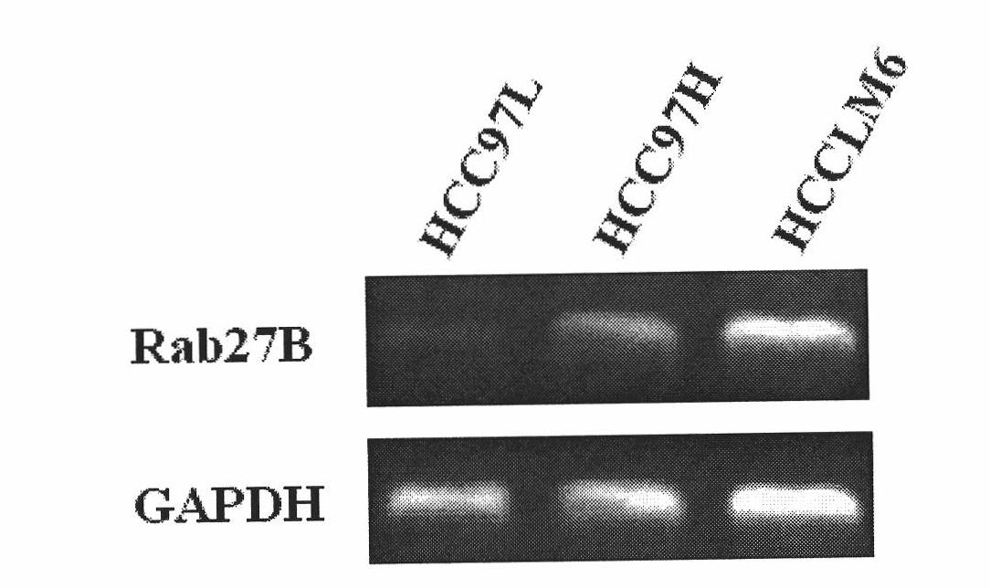 DNA fragment for peculiarly inhibiting Rab27B gene expression and application thereof