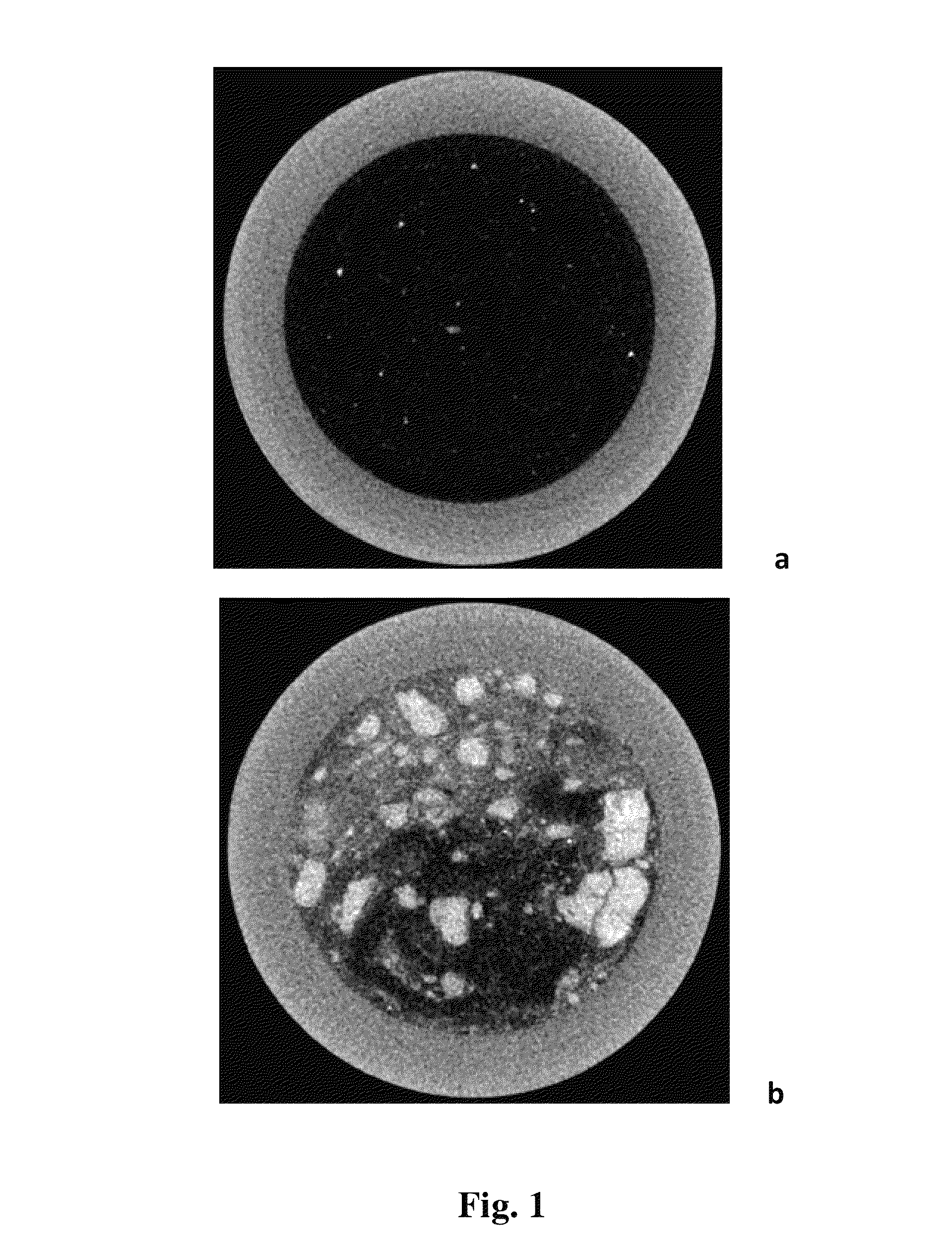 Method for determining spatial distribution and concentration of clay in a core sample