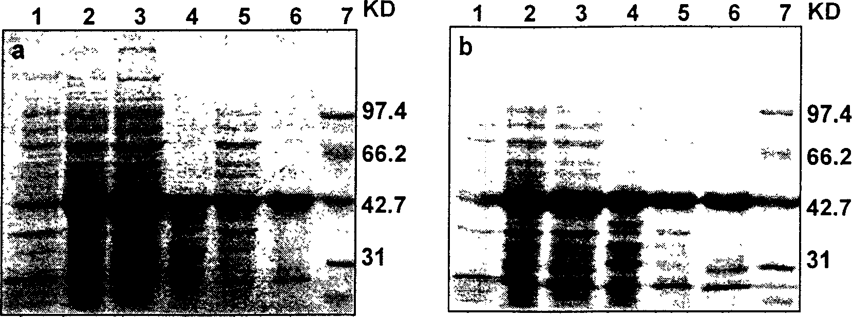 Fusion protein of immune globulin binding structural domain and fluorescence protein and its uses