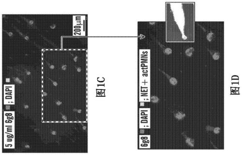 Methods for treating netosis and neutrophil activation