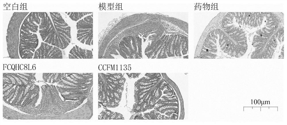 Application of lactobacillus reuteri in preventing and relieving ulcerative colitis