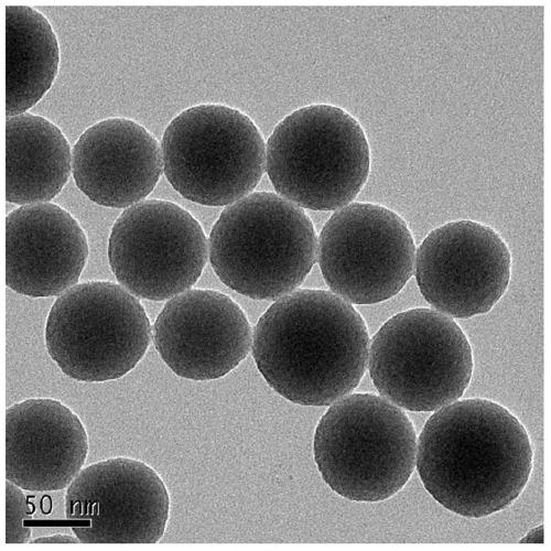 Integrated nanoprobe for diagnosis and treatment of bacterial infection in vivo and preparation method thereof