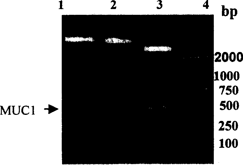 Recombination human Mucl-MBP fusion protein antitumour vaccine and production technology