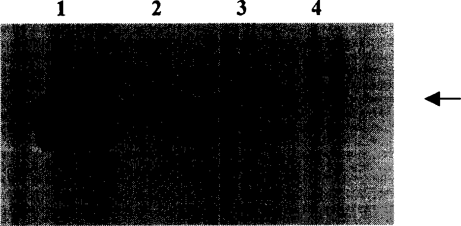 Recombination human Mucl-MBP fusion protein antitumour vaccine and production technology