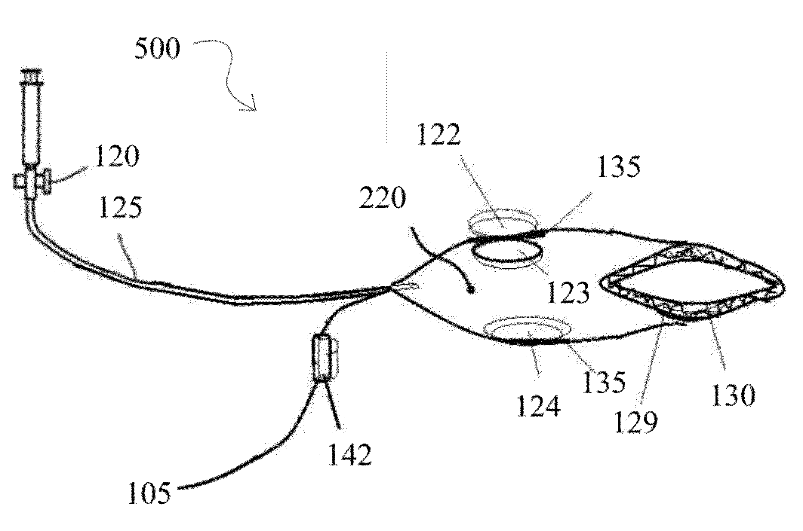 Devise for snoring and obstructive sleep apnea treatment