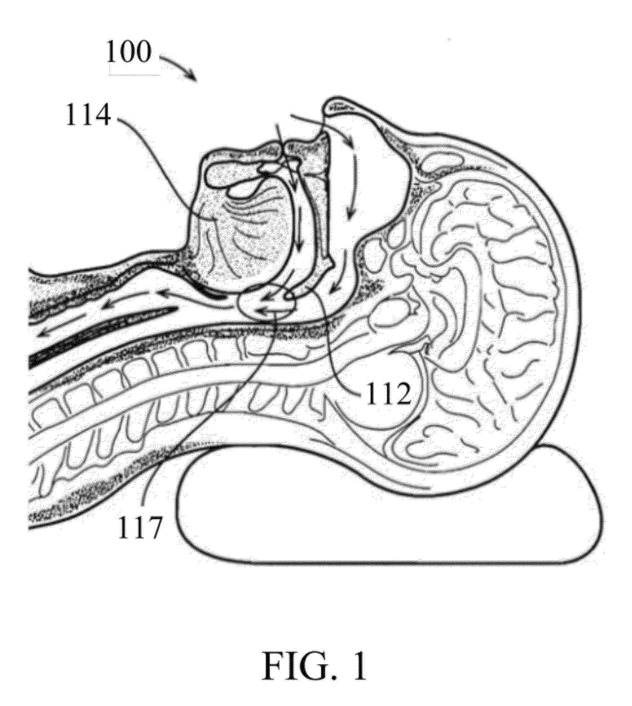 Devise for snoring and obstructive sleep apnea treatment