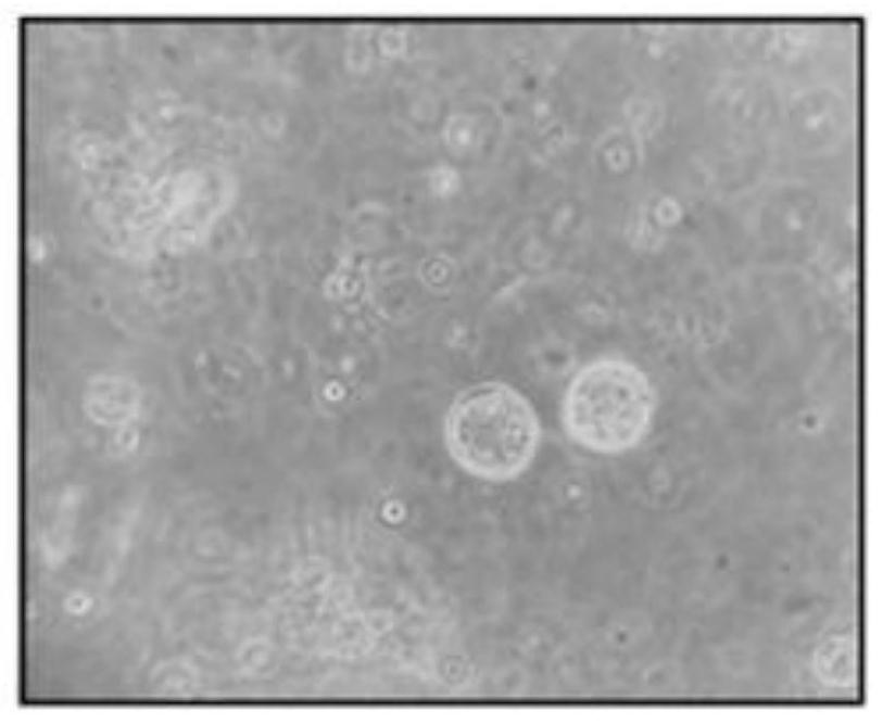 Oral squamous cell carcinoma organoid culture medium and culture method