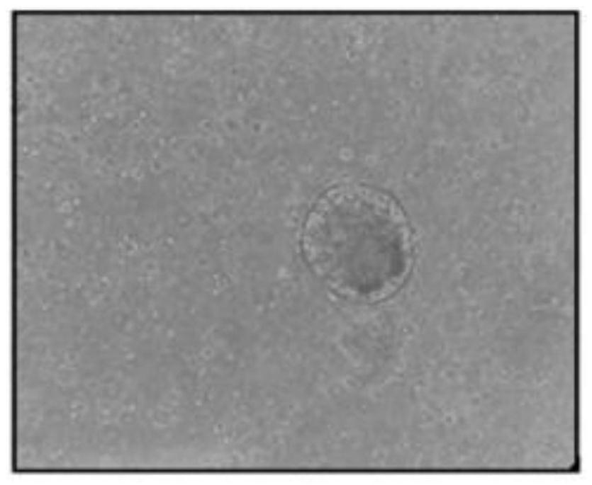 Oral squamous cell carcinoma organoid culture medium and culture method