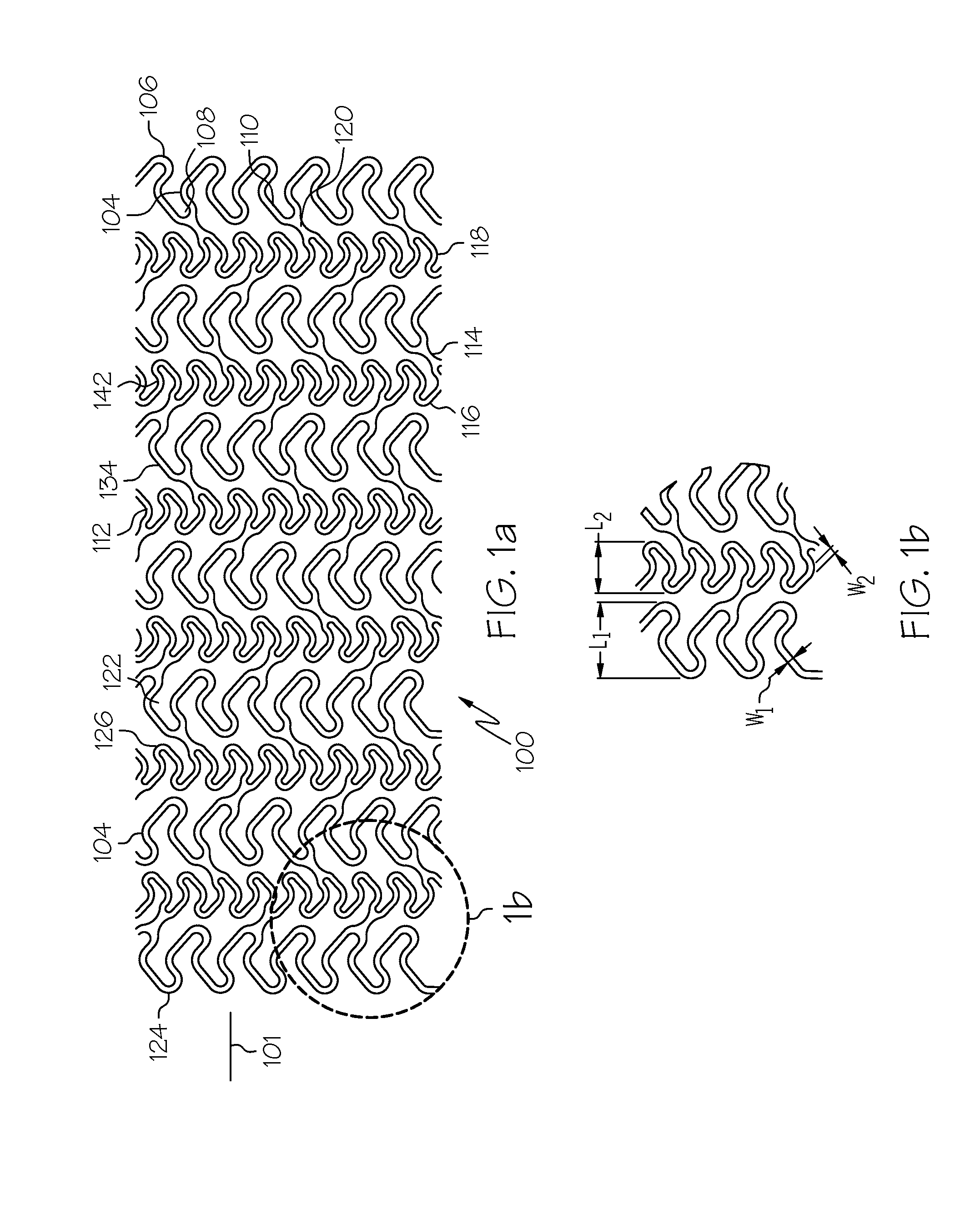 Stent