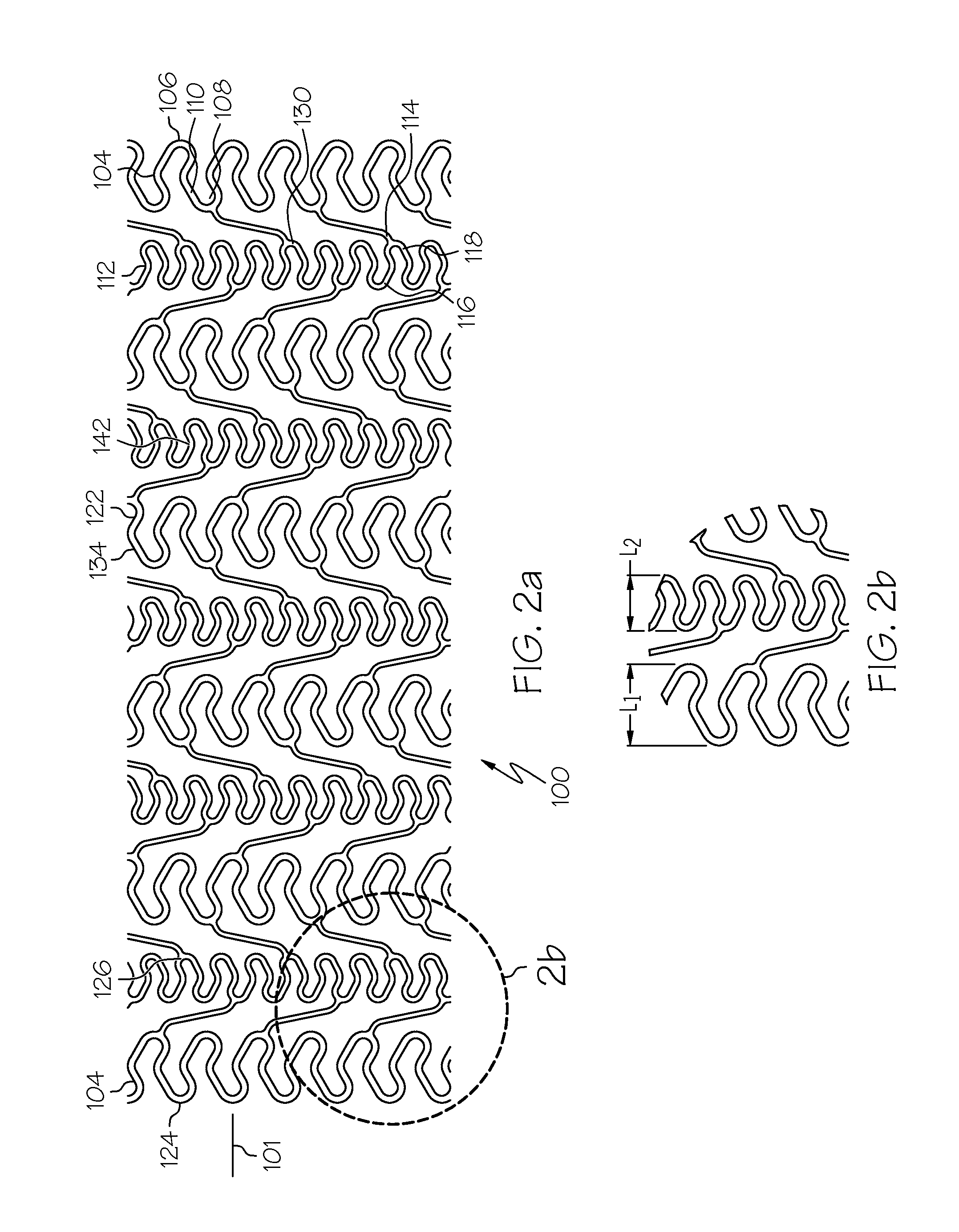 Stent