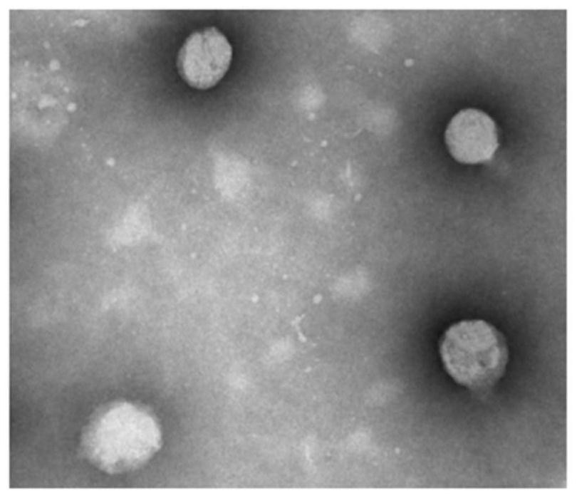 Squalene chidamide prodrug self-assembled nanoparticles, and preparation method and application thereof