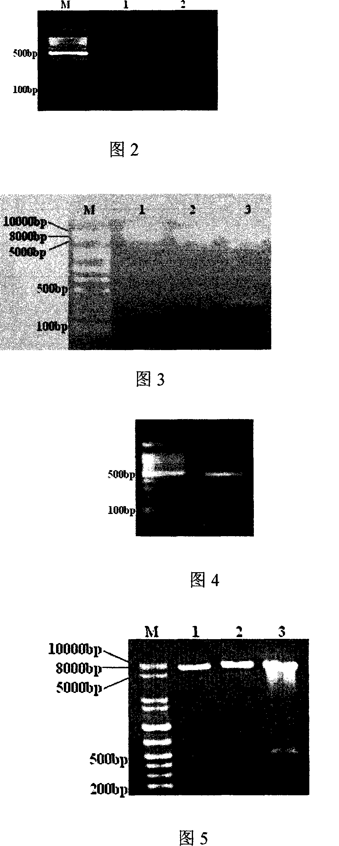 Acute progranulocyte leukemia DNA vaccine PML-RAR alpha 384-hIL-2 and preparing method and application thereof