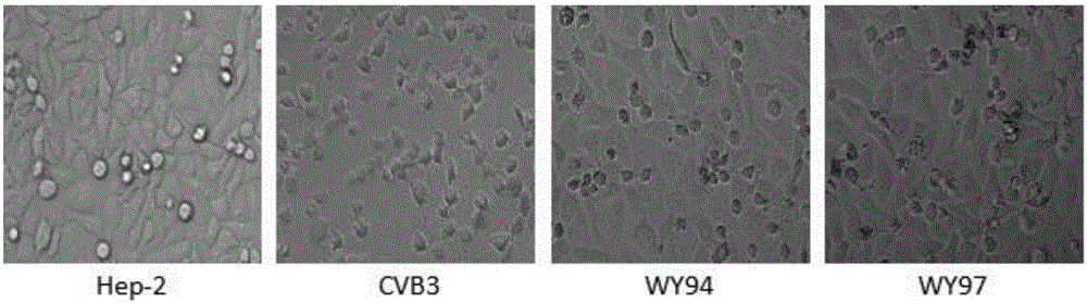 Use of pyridoheterocyclic ester compounds in manufacture of anti coxsackievirus B3 drugs