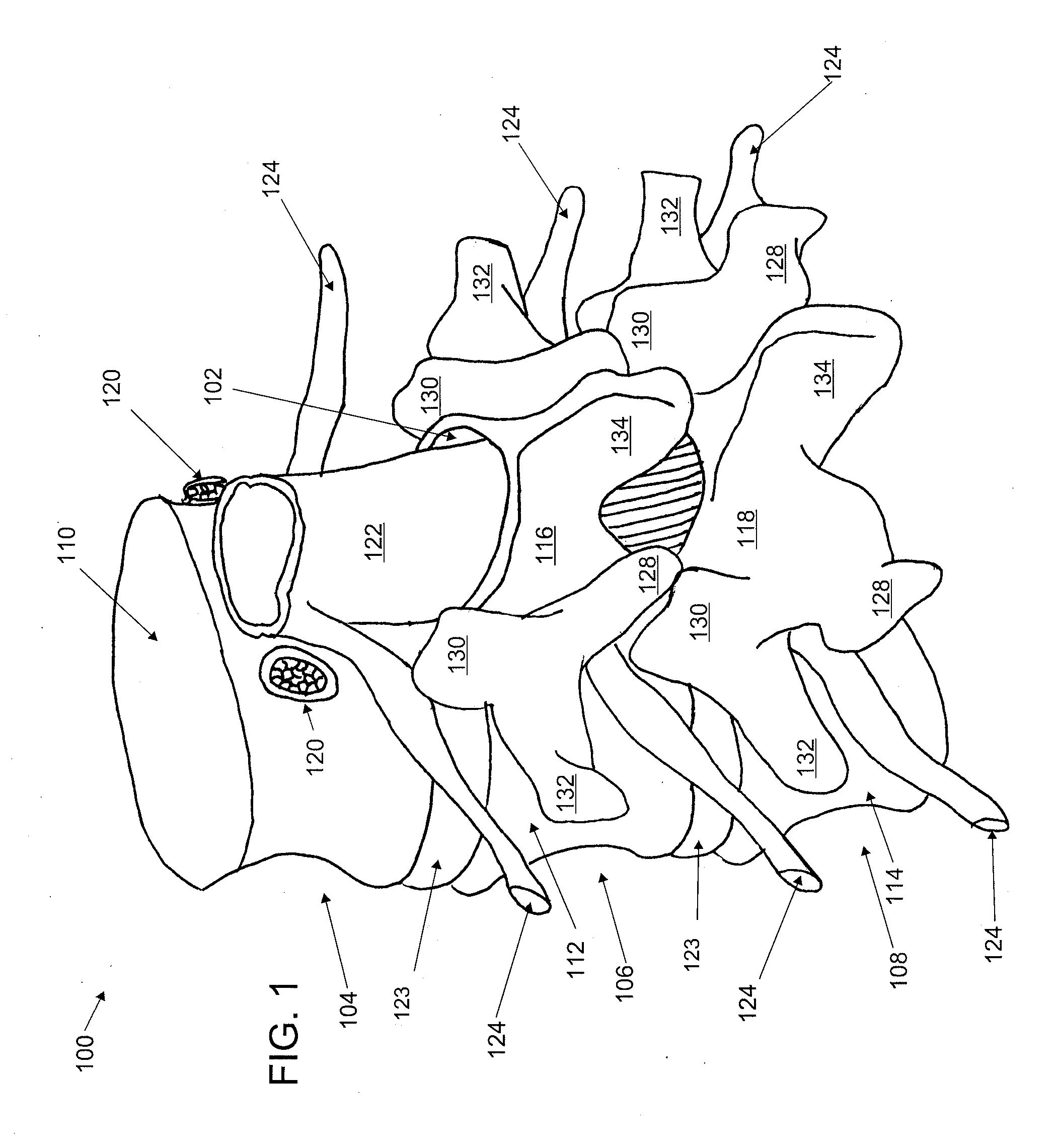 Devices and methods for arched roof cutters