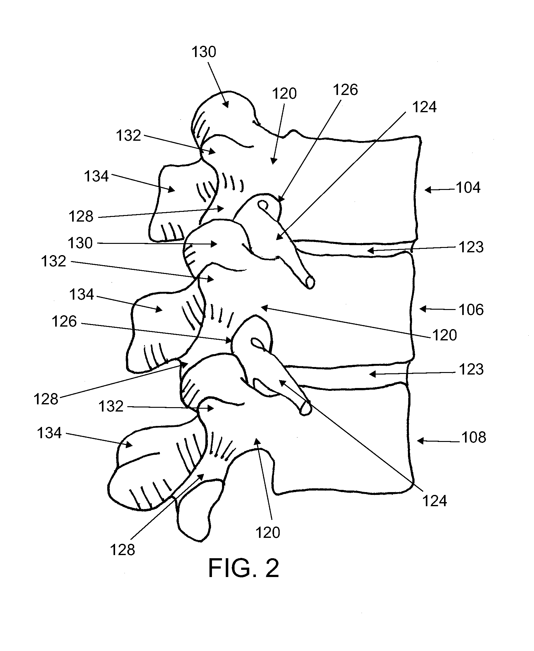 Devices and methods for arched roof cutters