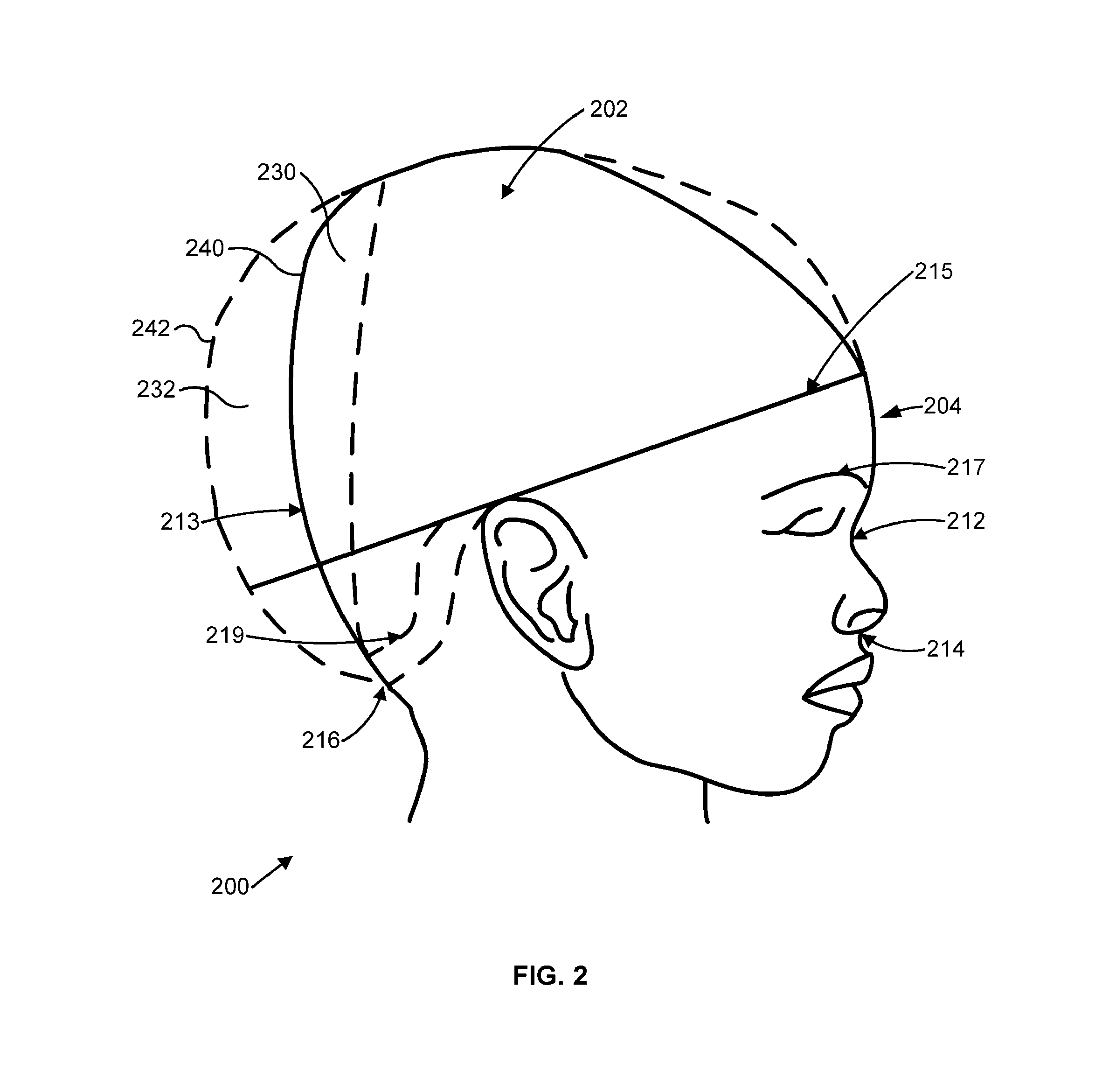 In situ molded orthotic and method for its fabrication