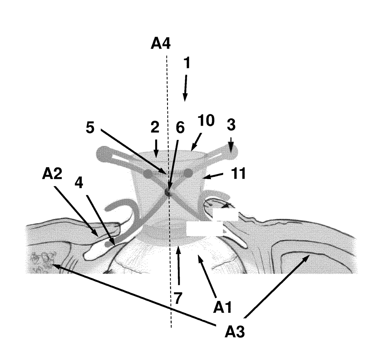 Device and method for fixing a relative geometric position of an eye