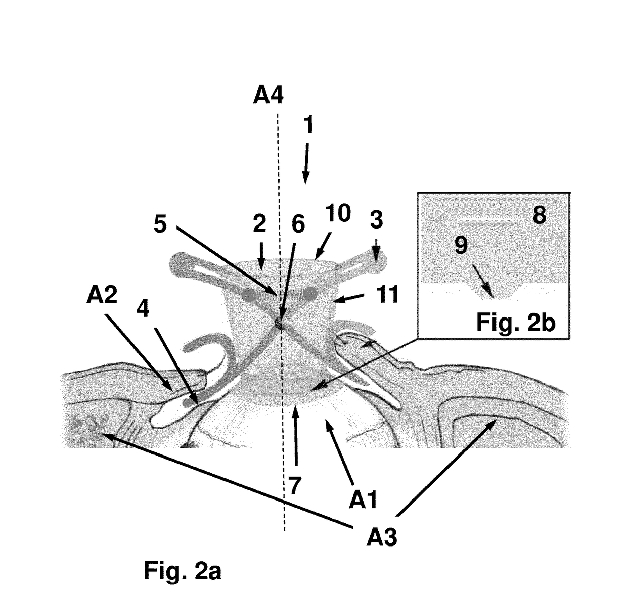 Device and method for fixing a relative geometric position of an eye