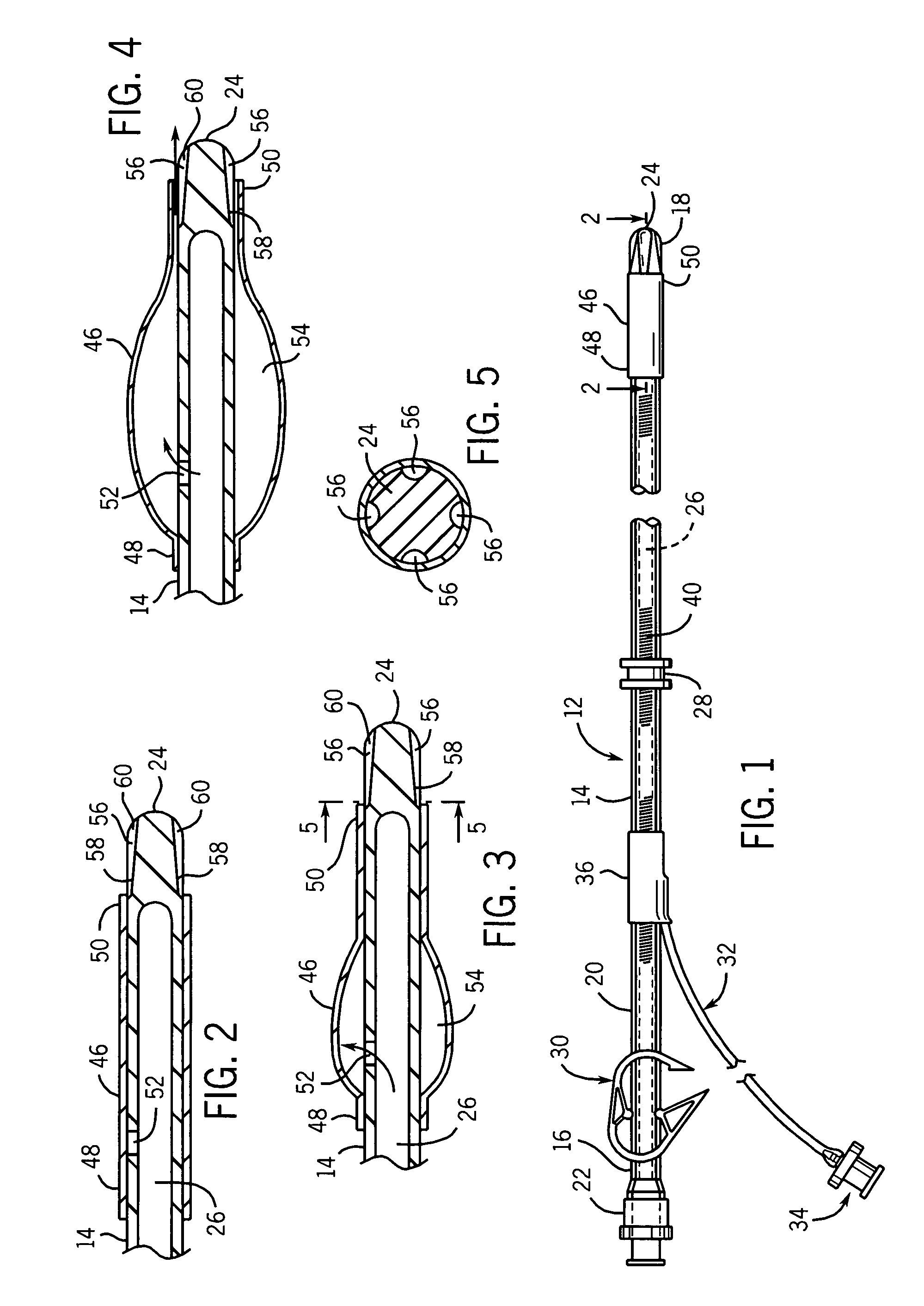 Catheter with autoinflating, autoregulating balloon