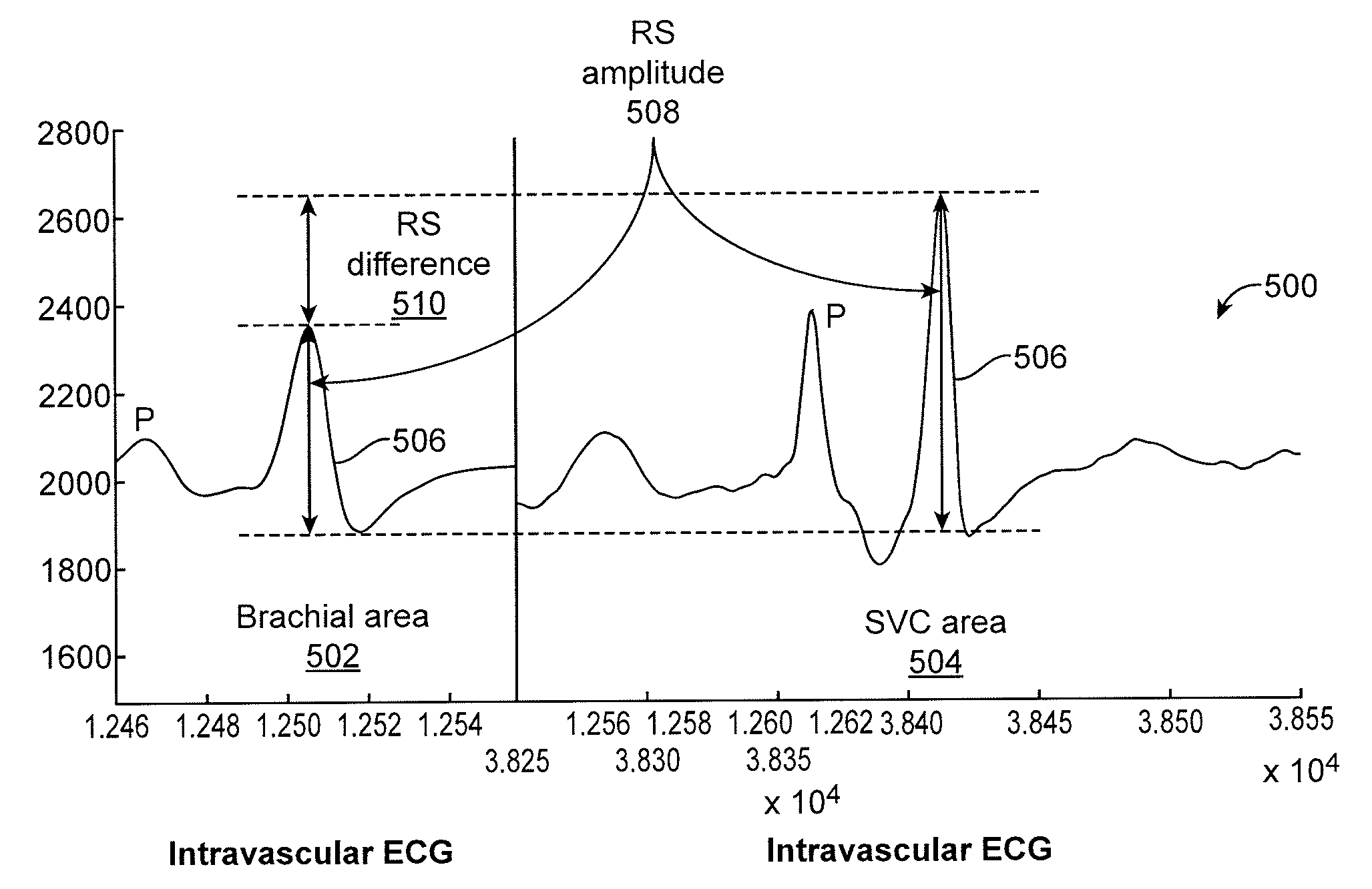 Systems and methods for detection of the superior vena cava area