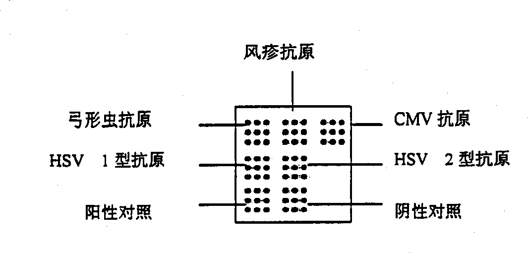 Protein-chip for prenated diagnosis and its preparing process